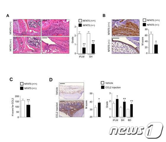 (A) NFAT5가 결핍된 마우스에서 관절파괴와 염증이 둔화된다. (B 와 C) NFAT5가 결핍된 마우스에서 대식세포의 관절조직 내 침윤 (B) 및 CCL2 발현 (C)이 감소한다. (D) NFAT5가 결핍 마우스에서 CCL2 단백질 주사에 의해 대식세포의 침윤과 관절염 중증도가 회복된다. © News1