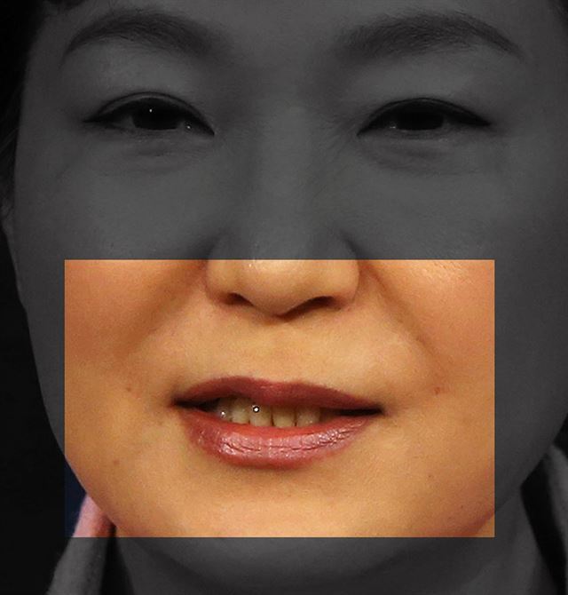 2014년 1월 6일 신년 내외신 기자회견을 하고 있는 박 대통령의 팔자 주름 선을 따라 주사바늘 자국으로 보이는 미세한 상처가 좌우 대칭된 위치에 나 있다. 의사들은 이 상처 역시 필러 시술의 특징인 주사바늘 자국으로 보인다는 의견을 밝혔다.