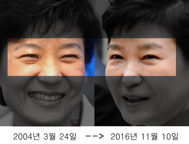 박 대통령의 눈 주변에 큰 변화가 보인다. 주름이 몰라보게 줄어들고 두툼했던 눈 밑 지방이 깨끗하게 정리돼 있다.