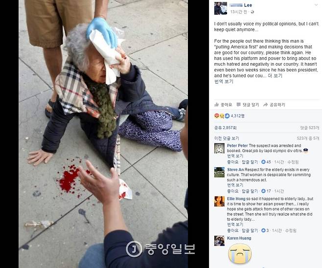 미국 로스앤젤레스에서 한국인 할머니가 백인 여성에게 길거리에서 폭행당하는 사건이 벌어졌다. [사진=페이스북]