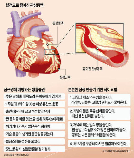 급성 심근경색 원인과 증상 5