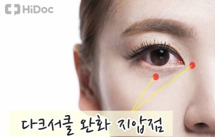 다클서클 완화 지압법