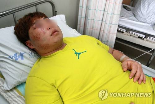 사재혁에게 폭행당한 황우만의 모습. 연합뉴스 제공