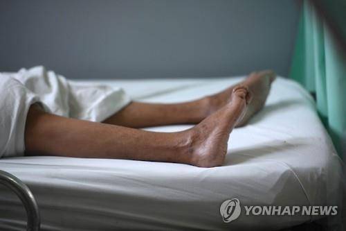 엘살바도르 길랭-바레 증후군 환자의 발(AFP=연합뉴스 자료사진)