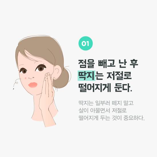 점 빼고 난 후 딱지는 저절로 떨어지게 둔다