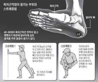 [헬스조선]스트레칭을 통해 족저근막염 자가치료와 증상완화가 가능하다./사진=조선일보 DB