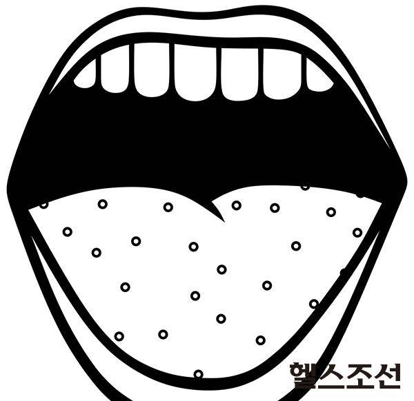 [헬스조선]여름철 3대 냄새, 입냄새
