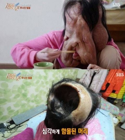 &amp;lt;세상에 이런 일이&amp;gt; 심현희 씨. 사진 SBS 화면 갈무리