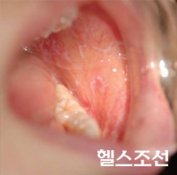 [헬스조선]
