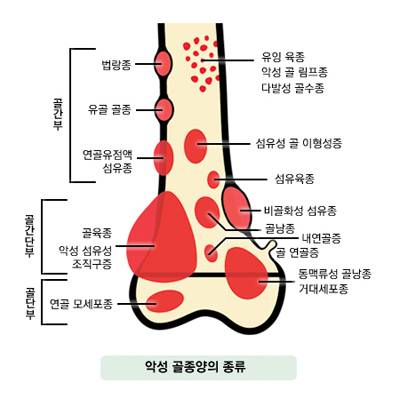 제공 국가암정보센터
