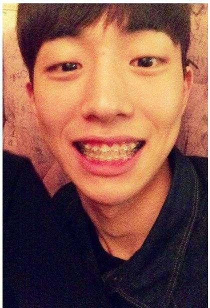 교정기를 부착한 남주혁 [사진 온라인 커뮤니티]