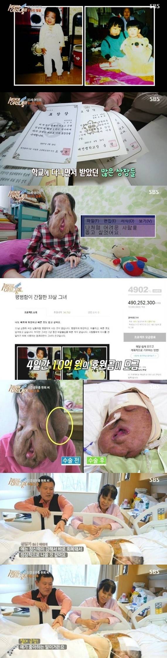 [사진 SBS '세상에 이런일이' 캡처]