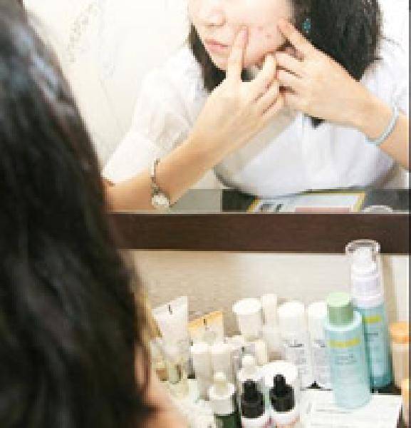 [헬스조선]여드름은 종류에 따라 원인과 치료법이 달라 구분해야 한다/사진=헬스조선 DB