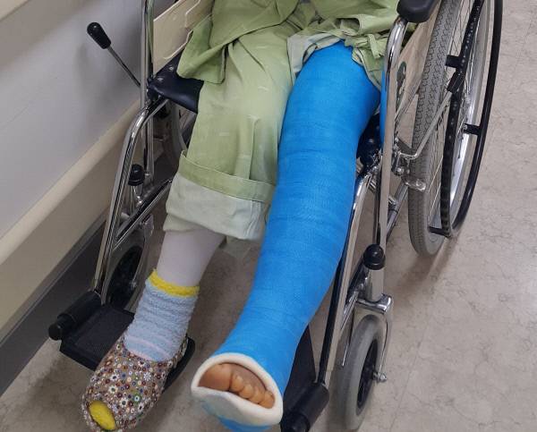 다리 골절 환자가 기존 석고붕대를 이용한 통깁스를 하고 휠체어에 앉아 있다. 박효순 기자