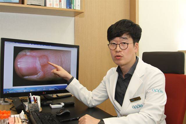 정홍대 피부과 전문의가 사마귀 증상이 나타나는 원인에 대해 설명하고 있다. 대구 애플피부과 제공.