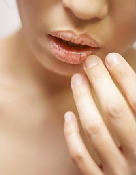 [헬스조선]입술이 건조할 때 침을 바르면 세균에 의해 2차 감염이 발생할 수 있다/사진=조선일보 DB