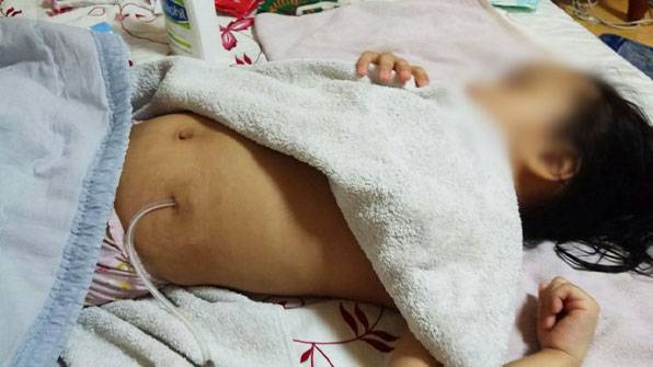 시은이의 투석 모습. HUS로 신장은 90% 가까이 기능을 상실해 시은이는 투석에 의존해야 하는 상황이다.