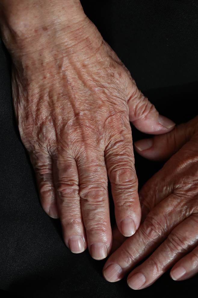 1928년 봄 경북 영일군에서 5남매 중 맏이로 태어난 이 할머니는 방직공장에 취직시켜주겠다는 말에 속아 1944년 북만주 목단강 위안소로 끌려갔다. ‘위안부 피해’를 알리기 위해 독일과 일본을 방문했던 할머니는 “위안부 생활 당시 임신이 돼 자궁을 적출 당했고 위안소에서 도망치다 일본군에 붙잡혀 엉덩이와 가슴 등에 인두질을 당했다”며 당시의 참혹한 상황을 증언했다.