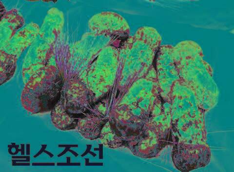 [헬스조선]송이버섯