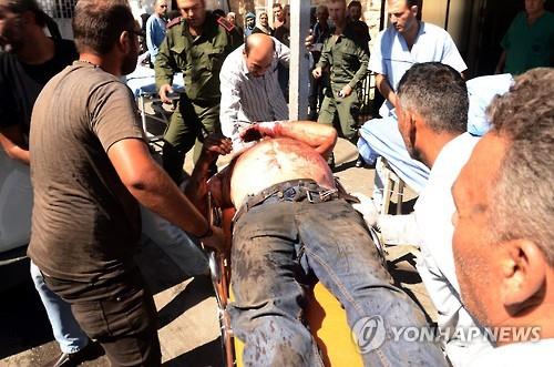 28일(현지시간) 알레포에서 공습으로 부상한 주민이 병원으로 옮겨지고 있다. [EAP=연합뉴스]