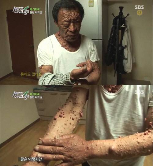 <세상에 이런 일이> 이동현 씨. 사진 SBS 화면 갈무리