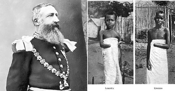 레오폴드 2세(좌), 손목이 잘린 콩고 어린이들(우)