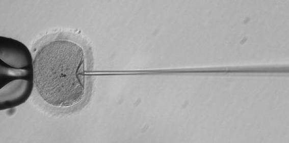 정상인의 난자(왼쪽)에 크리스퍼 유전자가위 효소가 녹은 수용액과 정자를 함께 주입하는 모습. / 미국 OHSU 제공