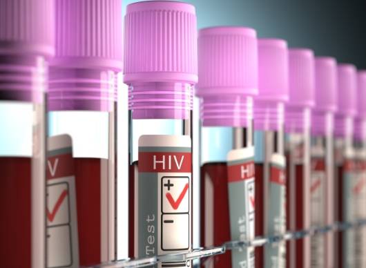 에이즈 혈액 샘플