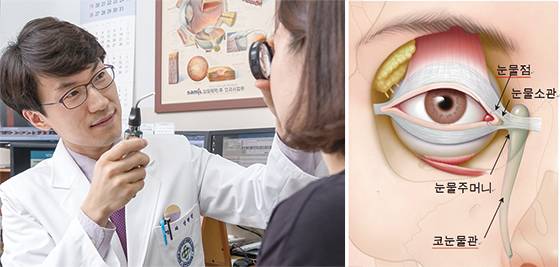 눈물흘림증은 눈물소관·코눈물관 등 눈물길이 막힐 때 발병한다. 안구건조증도 주요인이다. 눈물흘림증 치료법은 오히려 인공눈물을 투여하는 것이다. 신현진 건국대병원 안과 교수가 눈물흘림증 발병 원인에 대해 설명하고 있다.