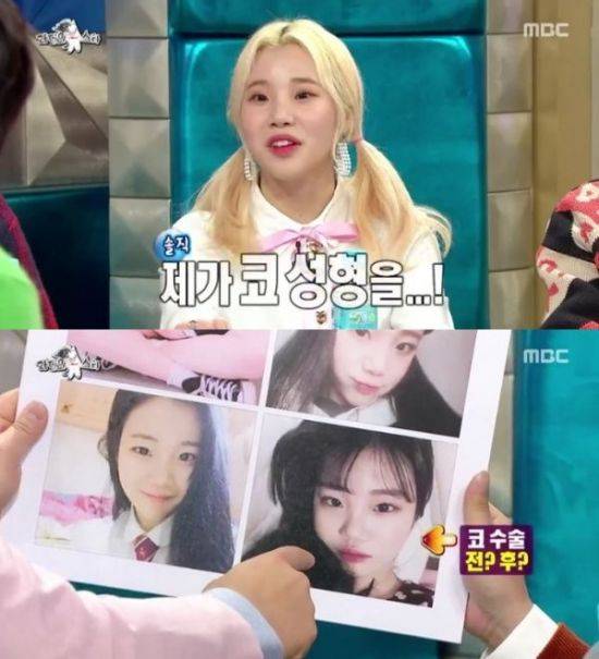 '라디오스타' 주이 / 사진=MBC 방송화면 캡처