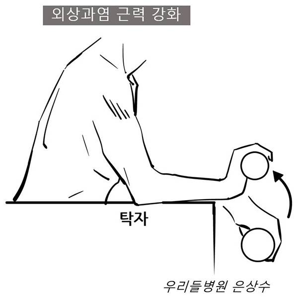 외상과염 근력강화 운동 /사진-은상수 전문의 제공