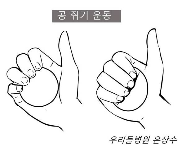 공 쥐기 운동 /사진-은상수 전문의 제공