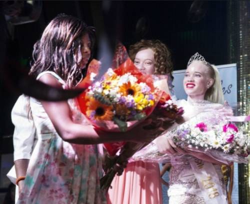 짐바브웨에서 열린 백색증(알비노) 미인 대회에서 우승한 세센비소(오른쪽)씨는 "우리는 ‘다를 수 있는 권리’를 주장하고 호소해야 한다"고 소감을 밝혔다.