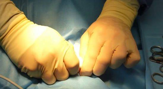 물리적 거세는 몇몇 국가에서 시행되고 있지만  잔혹하고 비정상적인 신체훼손형이란 비판 등 논란이 끊이지 않아 점차 사라지는 추세입니다.[사진=유튜브 화면캡처]