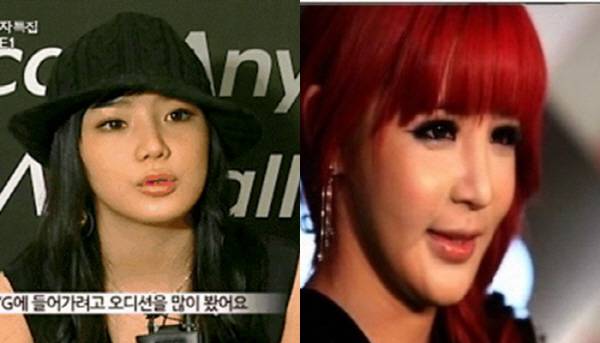 투애니원 박봄 성형 부작용? 얼마나 변했길래 헉! “제발 본인 자체를 사랑하길” “예뻤는데 안타깝다”