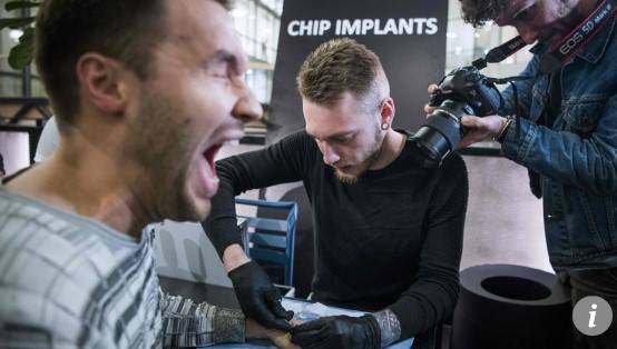 마이크로 칩을 이식하는 한 남성. [AFP=연합뉴스]