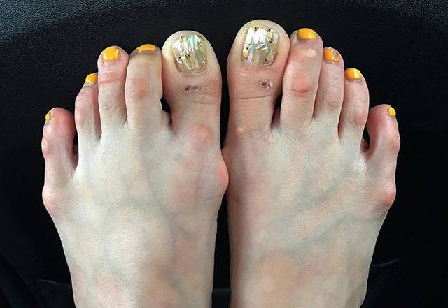 판매직 여성 노동자의 발.