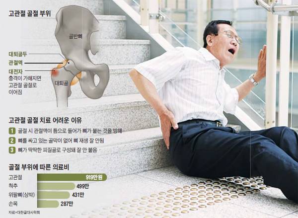 고령에서 흔한 고관절 골절은 뼈가 잘 붙지 않아 수술을 해야 하고 입원 기간이 길어 다른 부위 골절에 비해 의료 비용이 많이 든다. /사진=신지호 헬스조선 기자, 그래픽=송윤혜