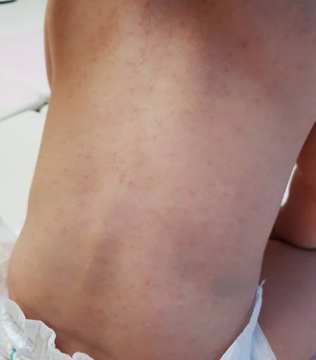 사진=고려대 구로병원 제공