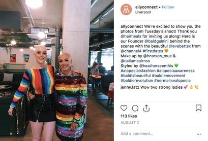 니콜라 맥어보이(왼쪽)와 에반젤린 베츠(오른쪽)의 사진이 해시태그 ‘#Alopeciaisfashion(탈모도 패션이다)’과 함께 소셜미디어에 올라와있다. /인스타그램 게시물