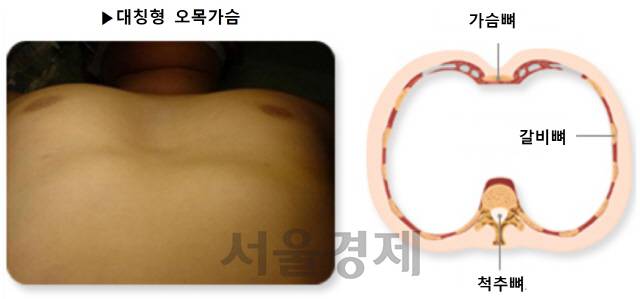 (보건복지부·대한의학회)