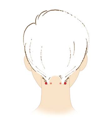 풍지혈/사진=자생한방병원 제공