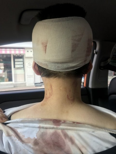 이수역 폭행의혹 사건의 피해자라고 주장한 여성이 최초 인터넷 글에 게시한 사진.