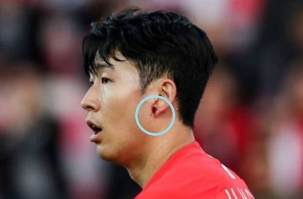 22일 두바이에서 열린 아시안컵 16강전에서 상대팀 선수의 거친 태클로 왼쪽 귀가 찢어지는 부상(파란색 원)을 입은 캡틴 손흥민. [사진=게티이미지코리아]