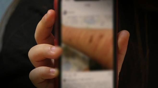 '추적60분' 청소년 자해 [KBS]