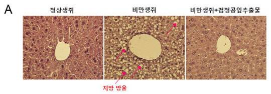 검정콩잎 추출물의 지방간 개선 효능을 보여주는 간 조직 현미경 사진으로, 정상 생쥐에 비해 고지방식 섭취로 비만, 고혈당과 함께 지방간이 유도된 비만생쥐의 간 조직 내 지방 축적이 증가해 지방방울의 생성이 현저히 증가됐다.    생명연 제공