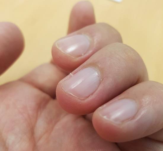 사진=고대안암병원