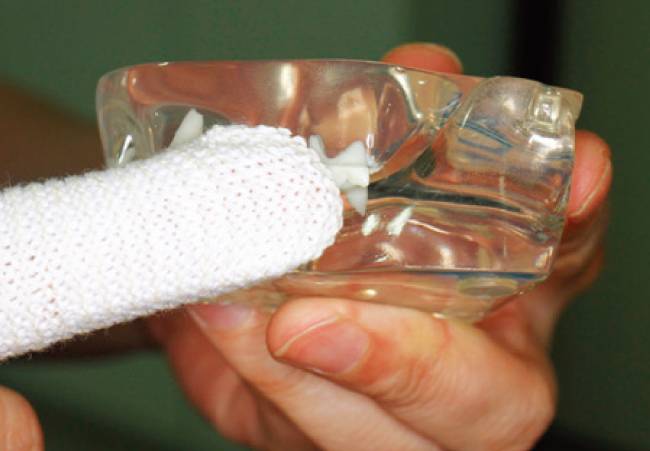 초보자라도 손가락 칫솔을 검지에 끼워 고양이 이빨을 문지르듯 닦으면 쉽게 양치를 시킬 수 있다. [사진 제공 · 이영수]