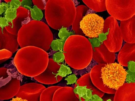 혈액은 면역 T 세포(주황색). 산소를 운반하는 적혈구(붉은색), 혈액응고를 담당하는 혈소판(초록색) 등으로 이루어져 있으며, 이런 기능성 세포들로 인해 맑지 않다.