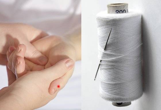 체했을 때 손을 따서 붉은 피가 나오면 체기가 없는 것, 검붉은 피가 나오면 단단히 체했다고 판별하는 것은 적절하지 않다. 혈액의 색상은 헤모글로빈이 산소와 얼마나 결합했는지에 따라 달라지는 것이기 때문이다. [사진 pixabay]